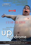 Up Syndrome